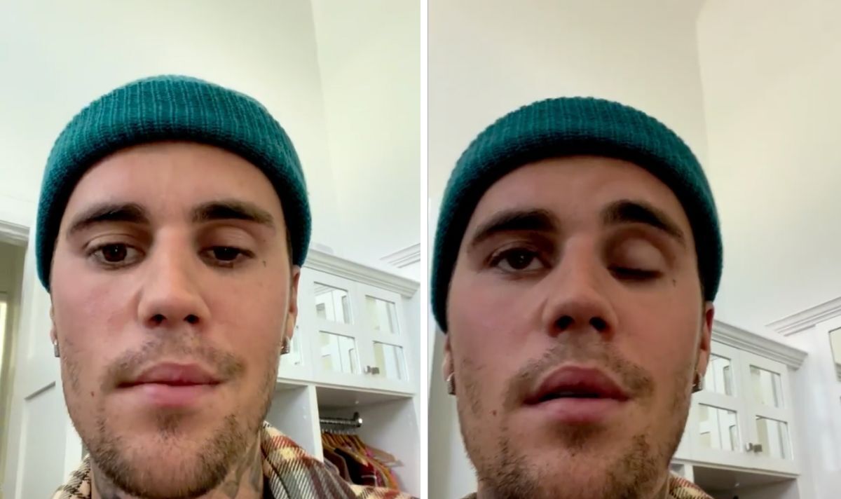 Justin Bieber urges fans ‘pray for him’ as star’s face left paralysed and unable to eat | Celebrity News | Showbiz & TV