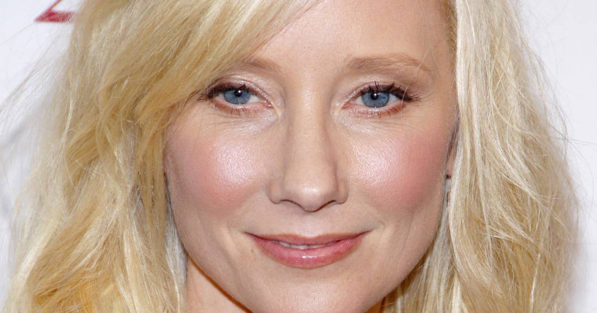 Anne Heche Severely Burned in Car Crash Fire, Hospitalized: Report