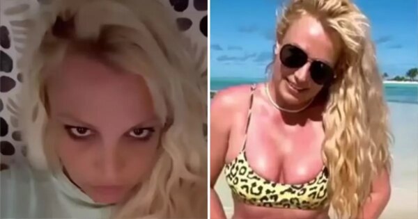 Britney Spears undergoes laser facial treatment after unveiling new hairstyle