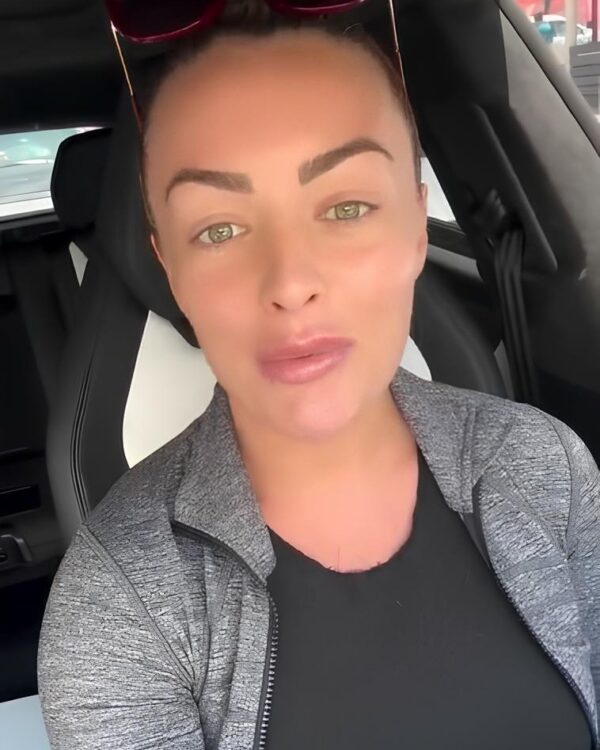 ???? #MandyRose unveils a new chapter! From reversing her lip fillers to diving into creative content, see how the former…