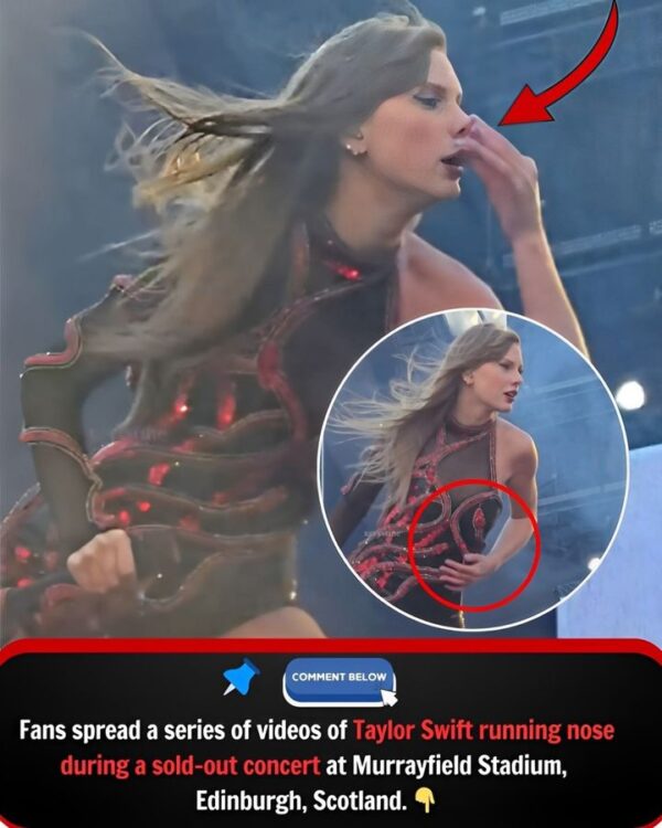 Performing in the 8-degree cold in Scotland, Taylor Swift had a runny nose and the singer had to wipe her nose on her dress more…