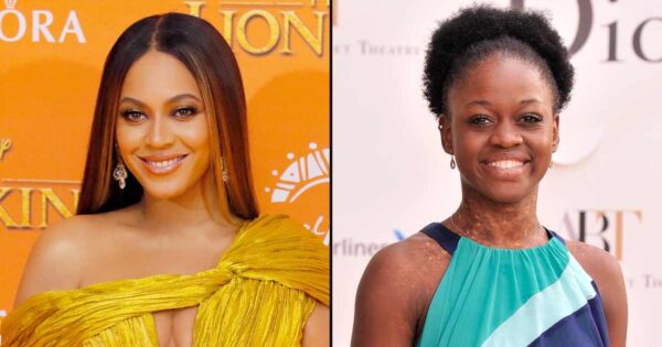 Beyonce Once Called Michaela DePrince a ‘Creature From Another Planet’