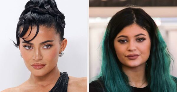 Kylie Jenner Opened Up About Going Through A Phase Of Heavily Editing Her Photos Before Slamming “Misconceptions” That She Underwent “So Much Surgery” Because She Was “Insecure”